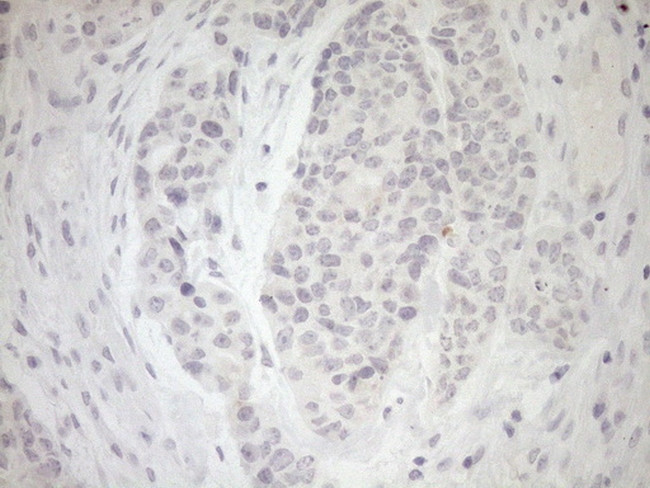 MYOZ1 Antibody in Immunohistochemistry (Paraffin) (IHC (P))