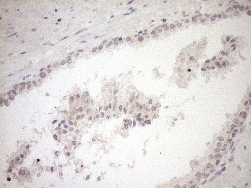 MYOZ1 Antibody in Immunohistochemistry (Paraffin) (IHC (P))