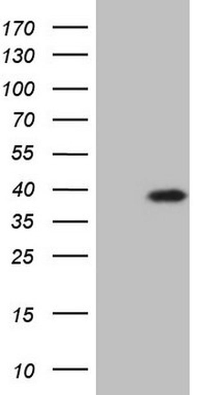 MYOZ1 Antibody in Western Blot (WB)