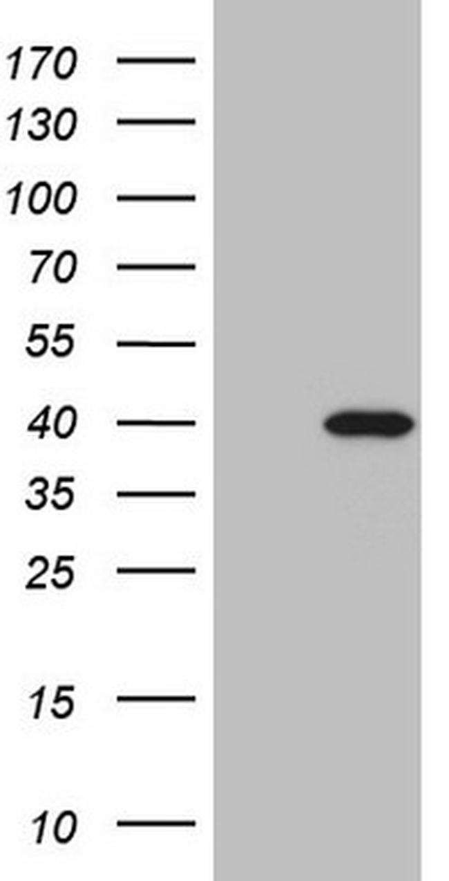 MYOZ1 Antibody in Western Blot (WB)