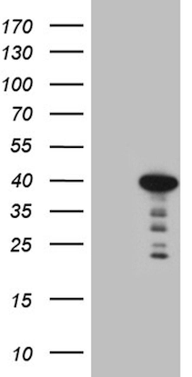 MYOZ1 Antibody in Western Blot (WB)