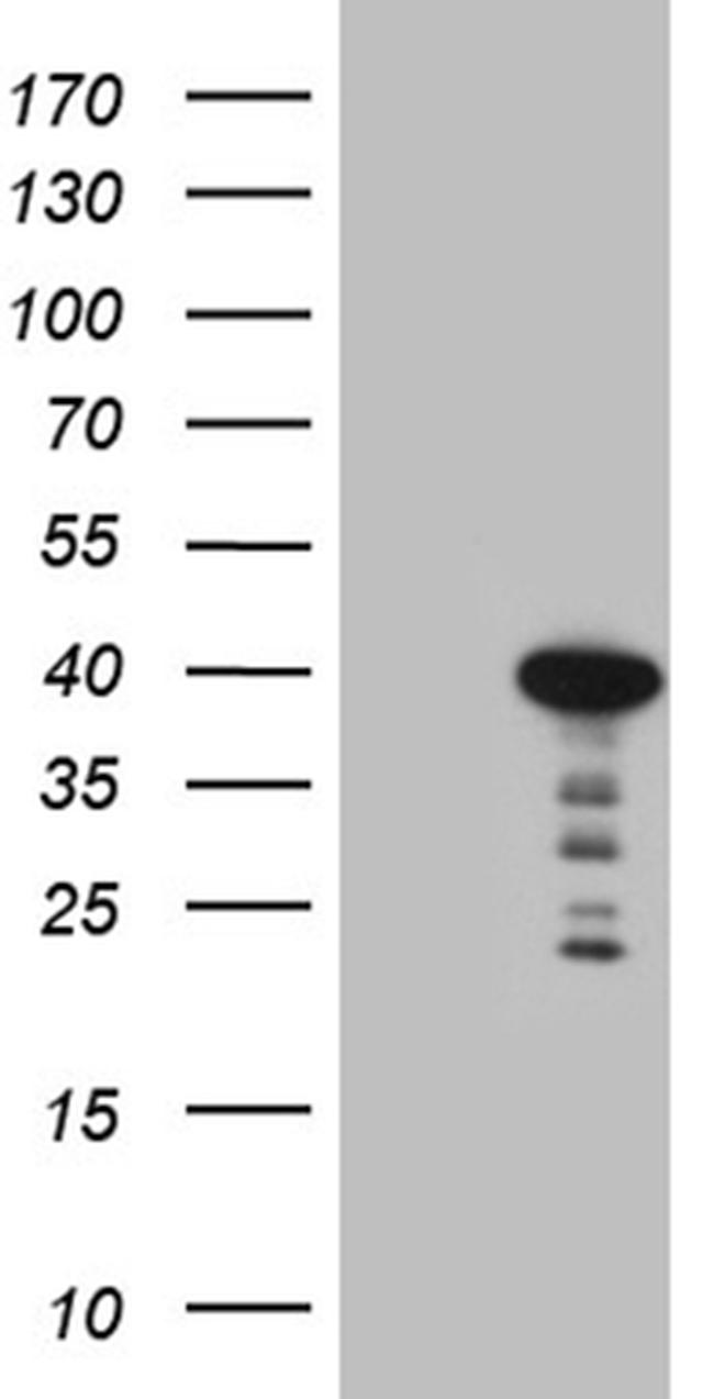 MYOZ1 Antibody in Western Blot (WB)
