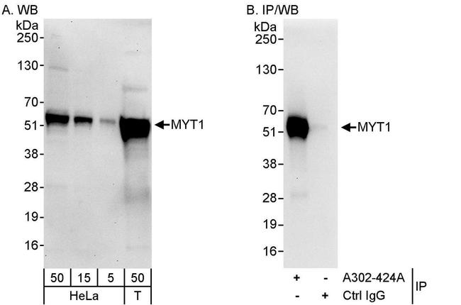 MYT1 Antibody in Western Blot (WB)