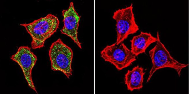 IGF2R Antibody in Immunocytochemistry (ICC/IF)