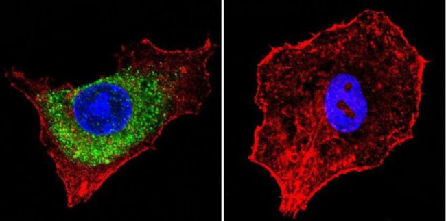 IGF2R Antibody in Immunocytochemistry (ICC/IF)