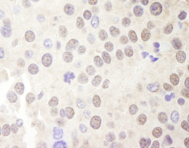 Menin Antibody in Immunohistochemistry (IHC)