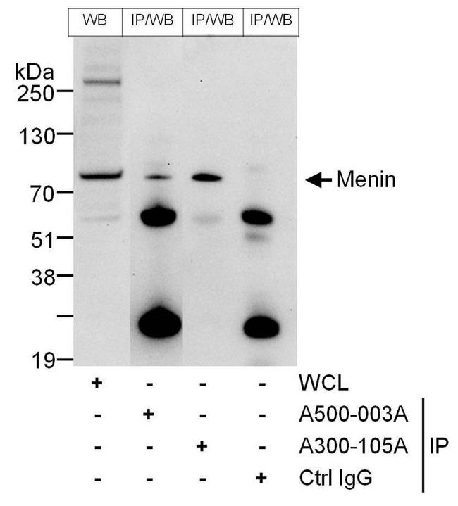 Menin Antibody in Western Blot (WB)