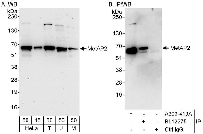 MetAP2 Antibody in Western Blot (WB)