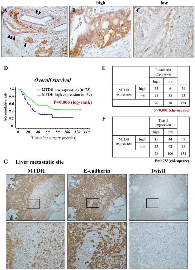 Metadherin Antibody in Immunohistochemistry (IHC)