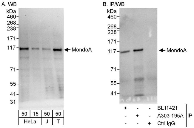 MondoA Antibody in Western Blot (WB)