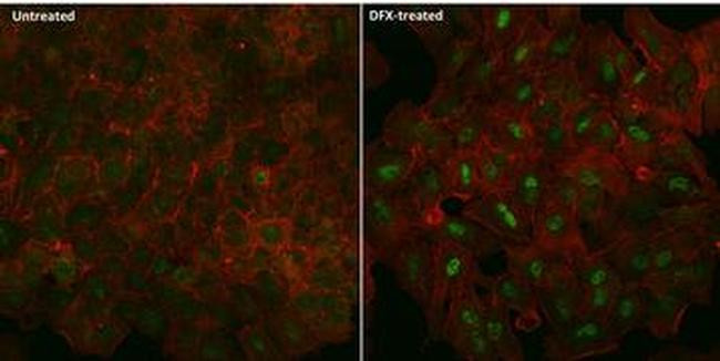 Mouse IgG (H+L) Cross-Adsorbed Secondary Antibody in Immunocytochemistry (ICC/IF)