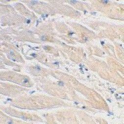 MyD88 Antibody in Immunohistochemistry (Paraffin) (IHC (P))