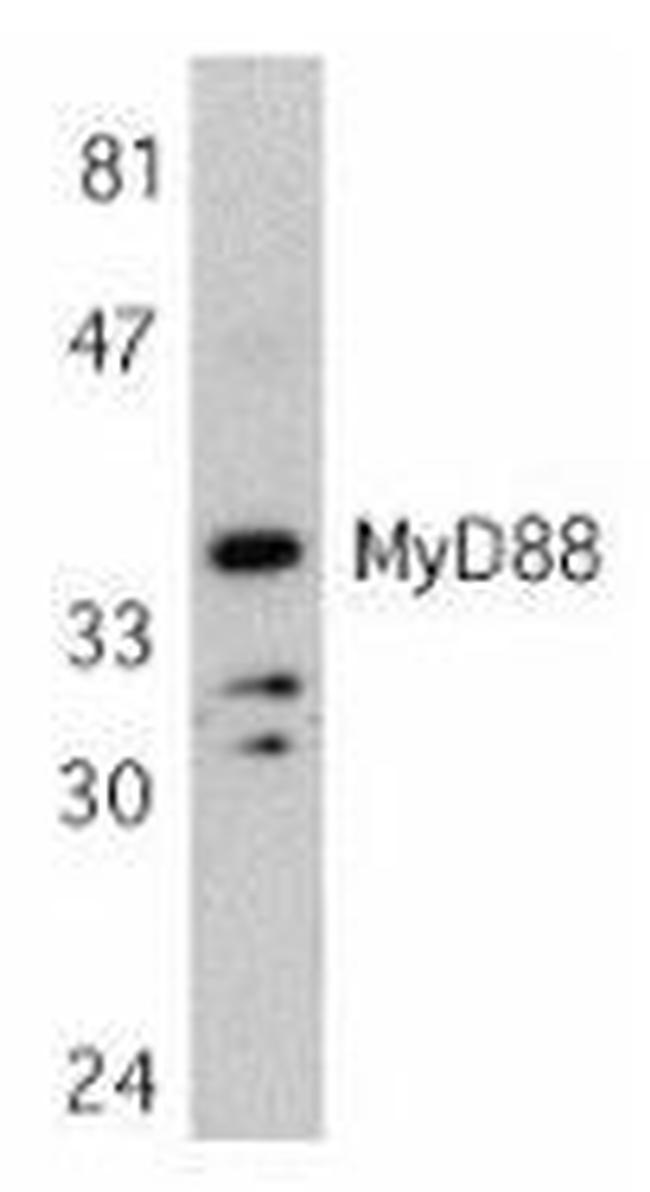 MyD88 Antibody in Western Blot (WB)