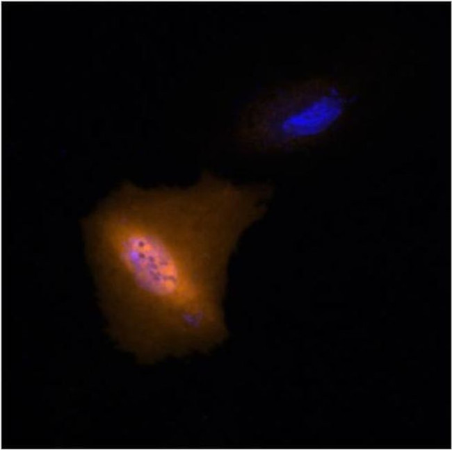 c-Myc Antibody in Immunocytochemistry (ICC/IF)