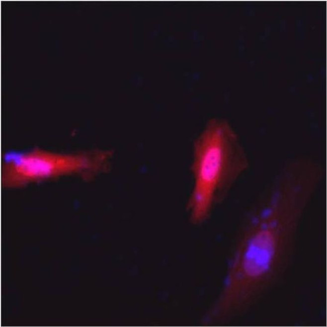 c-Myc Antibody in Immunocytochemistry (ICC/IF)