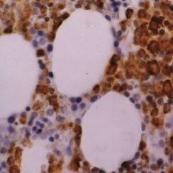 Myeloperoxidase Antibody in Immunohistochemistry (Paraffin) (IHC (P))