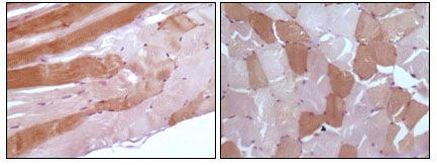 Myoglobin Antibody in Immunohistochemistry (Paraffin) (IHC (P))