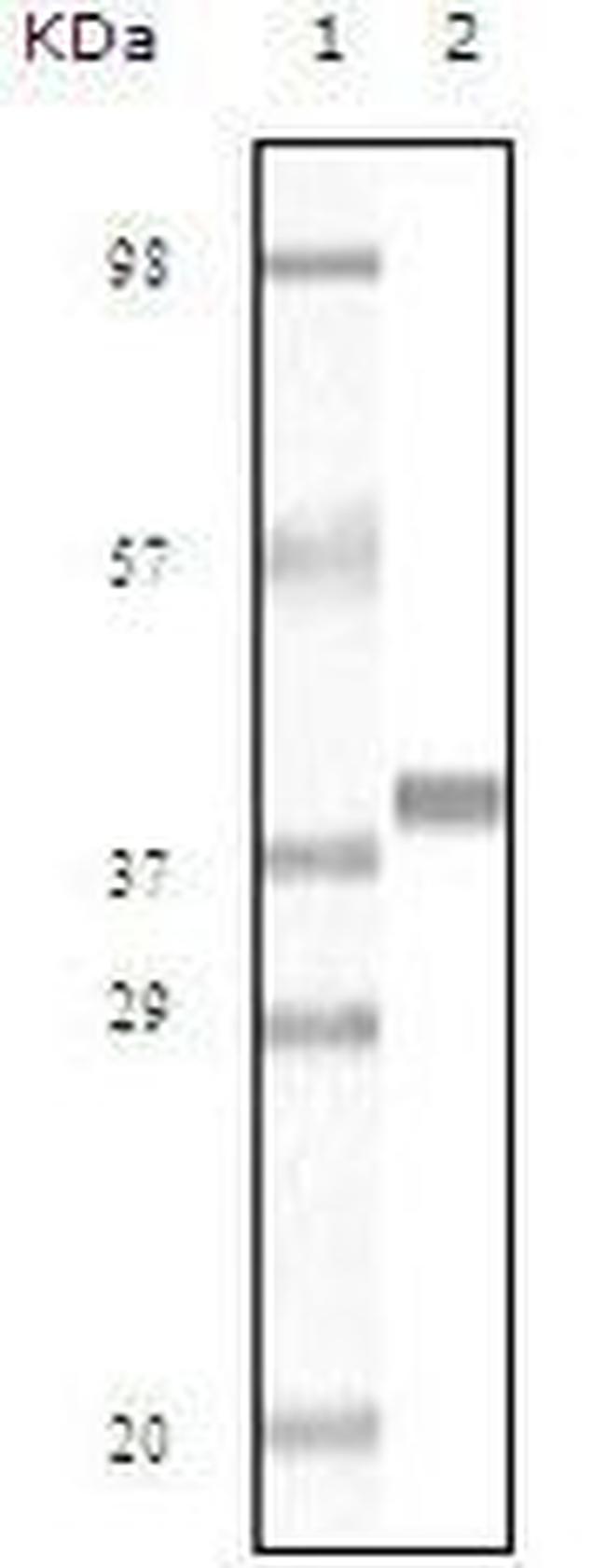 Myoglobin Antibody in Western Blot (WB)