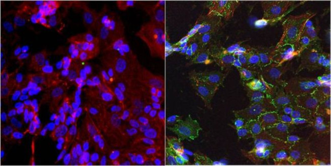 N-cadherin Antibody in Immunocytochemistry (ICC/IF)