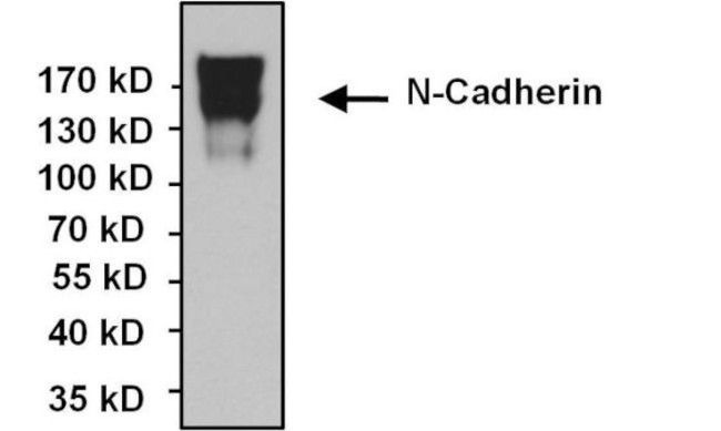 N-cadherin Antibody in Immunoprecipitation (IP)