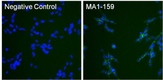 N-cadherin Antibody in Immunocytochemistry (ICC/IF)