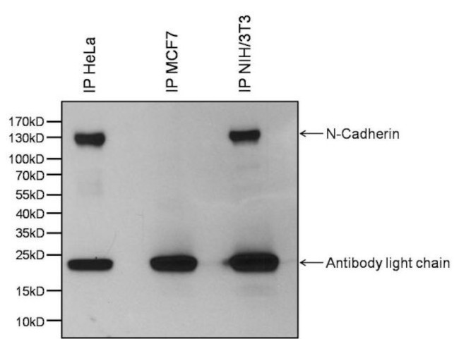 N-cadherin Antibody in Immunoprecipitation (IP)