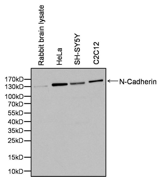 N-cadherin Antibody in Western Blot (WB)