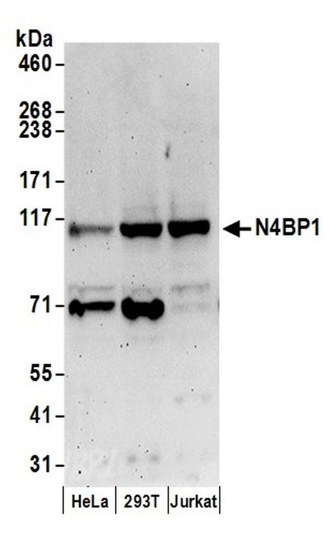 N4BP1 Antibody in Western Blot (WB)