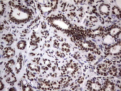 N4BP2L2 Antibody in Immunohistochemistry (Paraffin) (IHC (P))