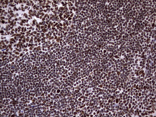 N4BP2L2 Antibody in Immunohistochemistry (Paraffin) (IHC (P))