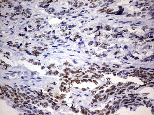 NAB1 Antibody in Immunohistochemistry (Paraffin) (IHC (P))