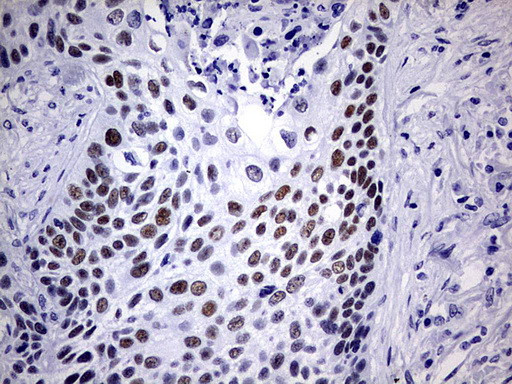 NAB1 Antibody in Immunohistochemistry (Paraffin) (IHC (P))