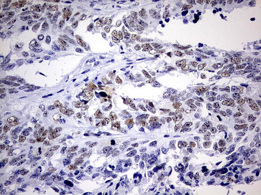 NAB1 Antibody in Immunohistochemistry (Paraffin) (IHC (P))