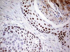 NAB1 Antibody in Immunohistochemistry (Paraffin) (IHC (P))