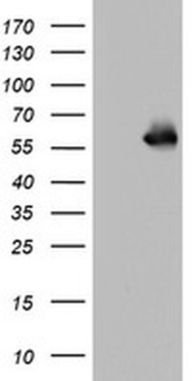 NAB1 Antibody in Western Blot (WB)