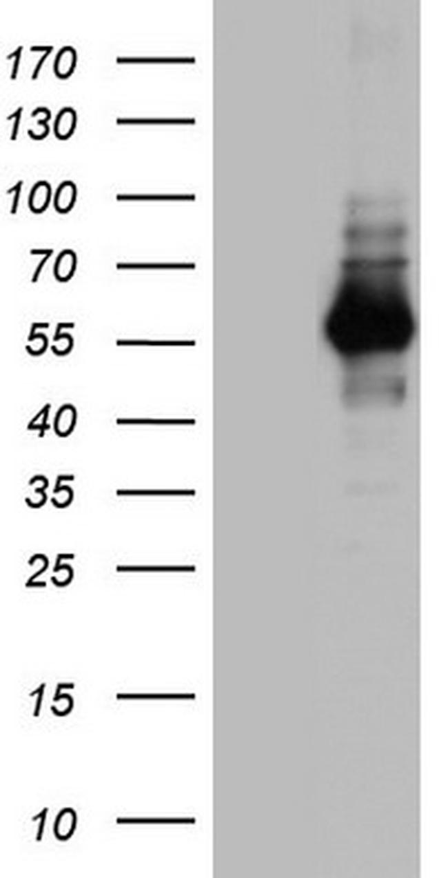 NAB1 Antibody in Western Blot (WB)