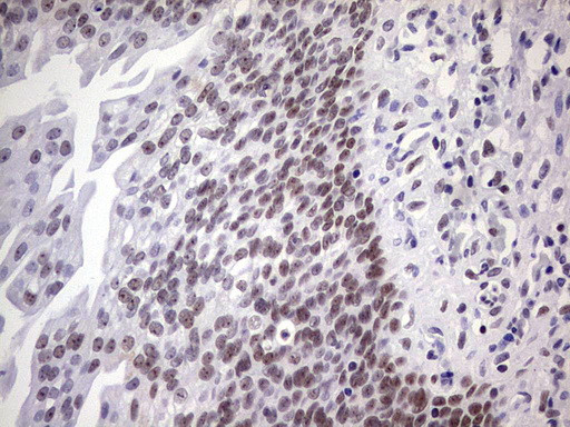 NAB2 Antibody in Immunohistochemistry (Paraffin) (IHC (P))