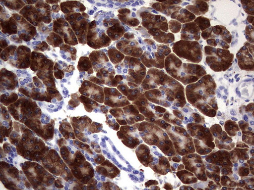 NAB2 Antibody in Immunohistochemistry (Paraffin) (IHC (P))