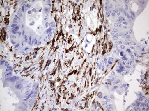 NAB2 Antibody in Immunohistochemistry (Paraffin) (IHC (P))