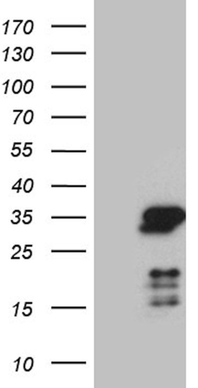 NABP1 Antibody in Western Blot (WB)