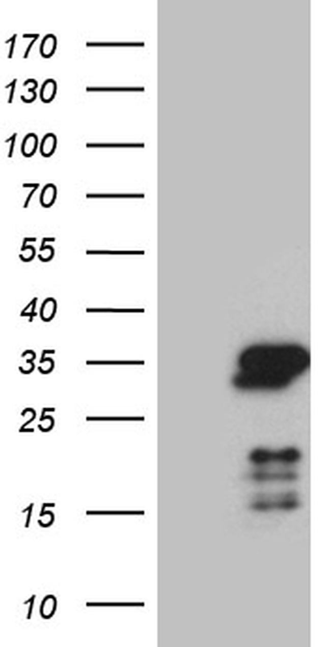 NABP1 Antibody in Western Blot (WB)