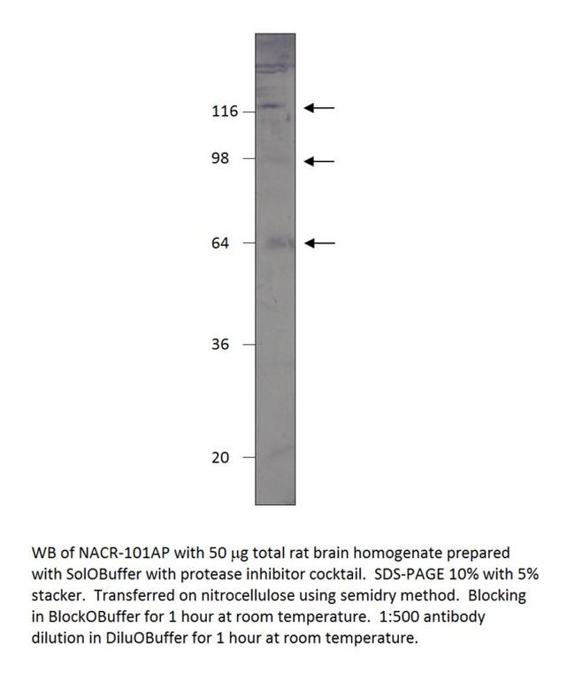 Nicotinic Acetylcholine Receptor alpha 7 subunit 2 Antibody in Western Blot (WB)