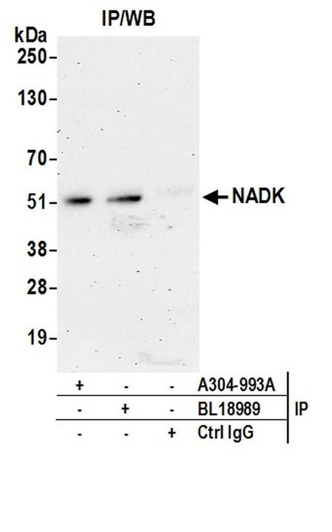 NADK Antibody in Western Blot (WB)