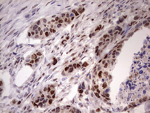 NAE1 Antibody in Immunohistochemistry (Paraffin) (IHC (P))