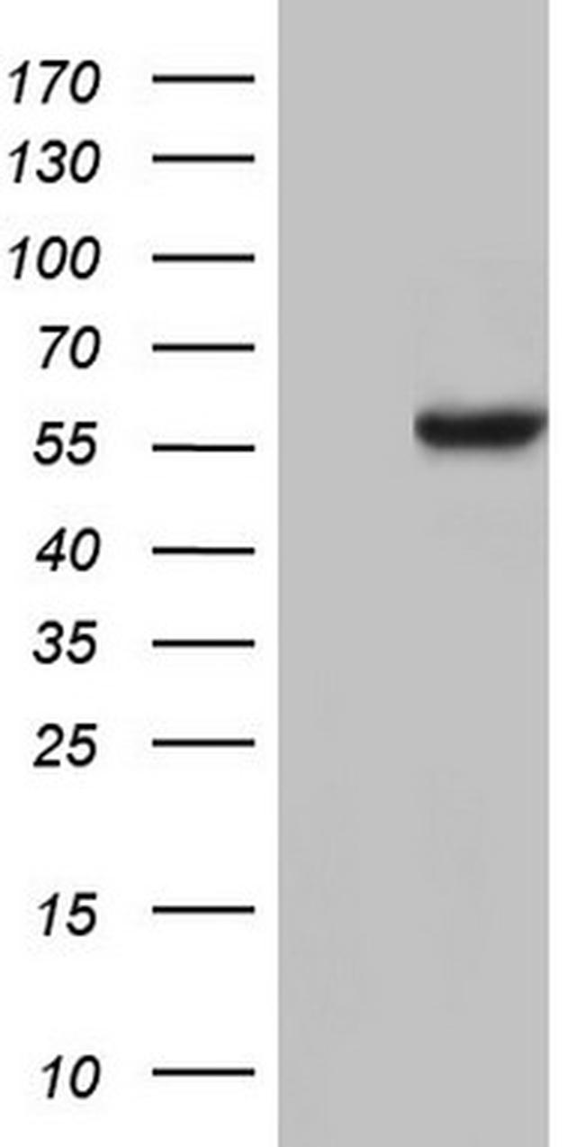 NAE1 Antibody in Western Blot (WB)