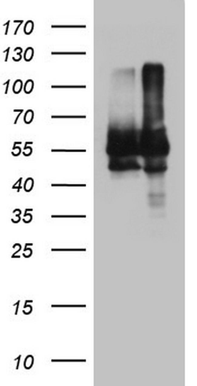 NAE1 Antibody in Western Blot (WB)