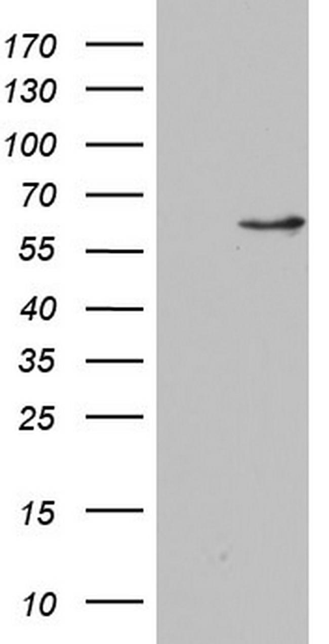 NAE1 Antibody in Western Blot (WB)