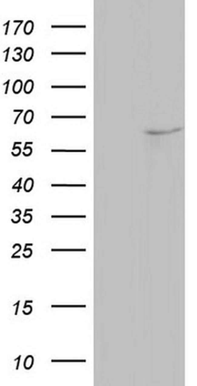 NAE1 Antibody in Western Blot (WB)