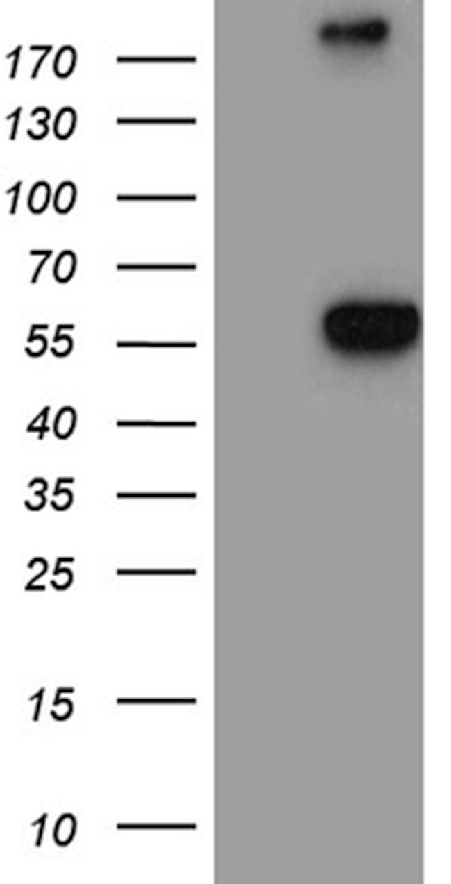 NAGA Antibody in Western Blot (WB)