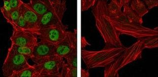 Nanog Antibody in Immunocytochemistry (ICC/IF)